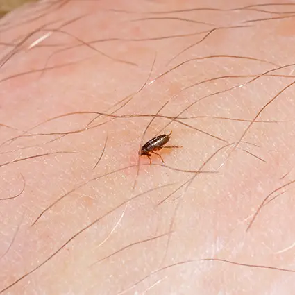 A flea on a person's knee - Keep fleas away from your home with Assured Environments in NY